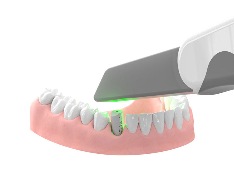 Intra-Oral Scan Bodies